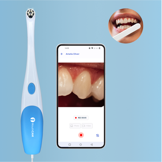 USB Personal Dental Intraoral Camera